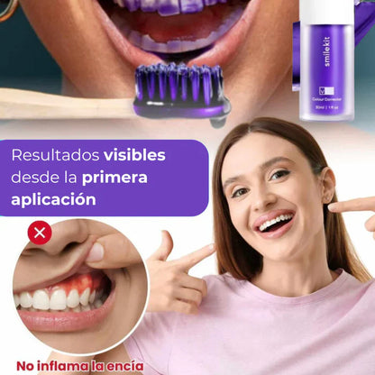 Hismile V34® Blanqueamiento rápido y efectivo