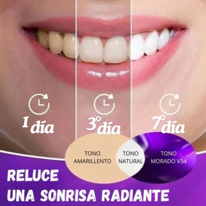 Hismile V34® Blanqueamiento rápido y efectivo